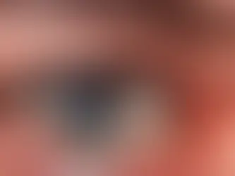 Ojo Seco: Causas y Tratamientos actuales