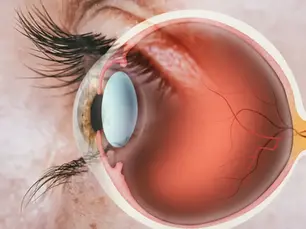 Diabetes y visión: 5 señales de alarma que no debes ignorar