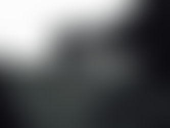 Subtle Aesthetic Treatments for Men: What to Expect (Without Looking Overdone)