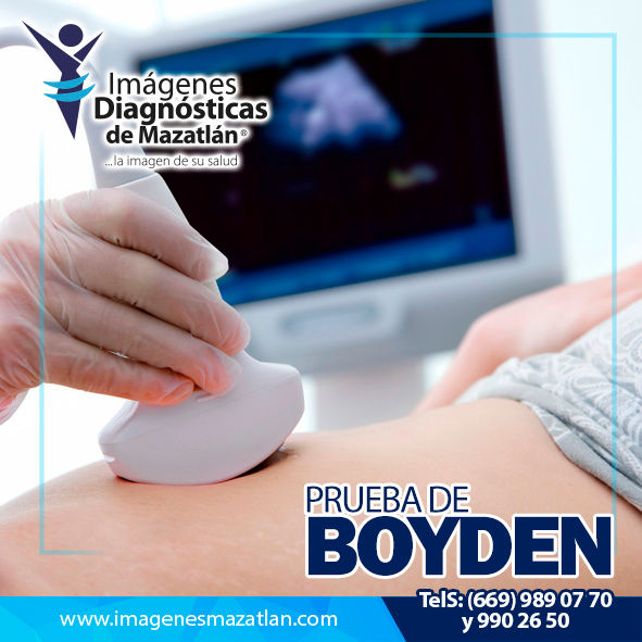 PRUEBA DE BOYDEN