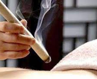 tcm&akupunktur-düsseldorf-moxibustion
