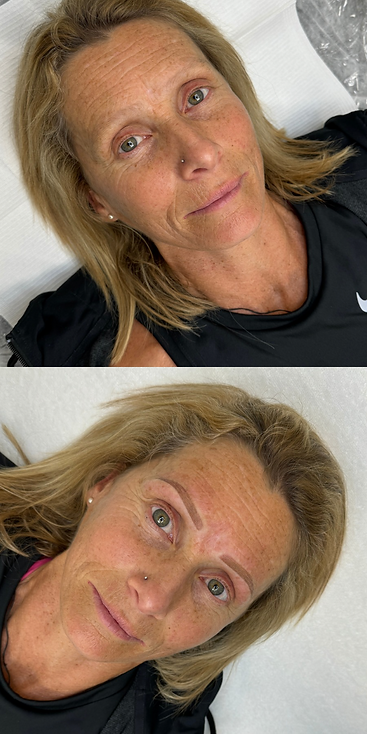 Mature Eyebrow Tattooing