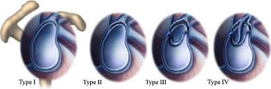 Slap Lesion Classification