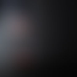 Objawy zespołu uzależnienia od alkoholu.