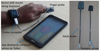 Wrist_Worn_SpO₂_Monitor.jpg