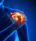 Physiotherapy in Halifax - Rotator cuff tears
