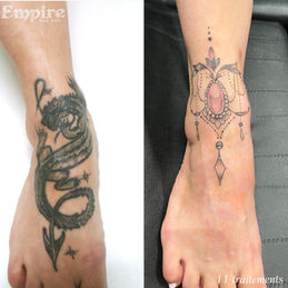 Détatouage complète - pâlir avant un nouveau tatouage - Empire Détatouage Québec
