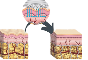 Dermatude MetaTherapy bei Estetica Köln