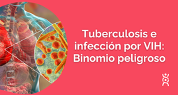 Tuberculosis e infección por VIH: Binomio peligroso