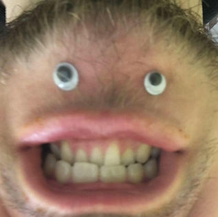 Googly | Ryan Ashkenase