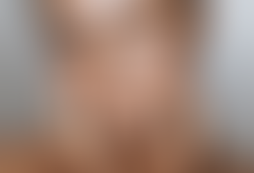 Keeping Your Skin Clear and Calm from Stress