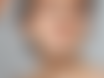 Woman with neutral expression applies serum to her cheek using a dropper. Close-up, clear skin, natural makeup, soft lighting.