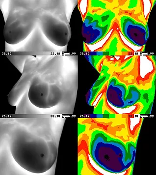 Alternative Breast Health Imaging