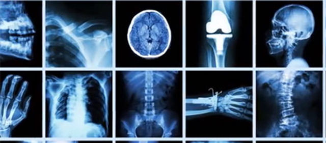 x-ray.jpg