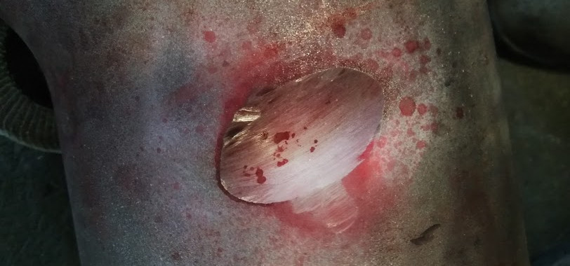 Shrinkage didalam casting, nambak setelah dilakukan penetrant test