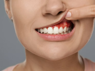 How to Keep a Hole in Gum Clean and Free from Infection