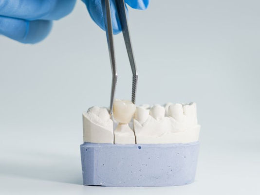 9 Ways to Save on Tooth Crown Cost Without Compromising Quality