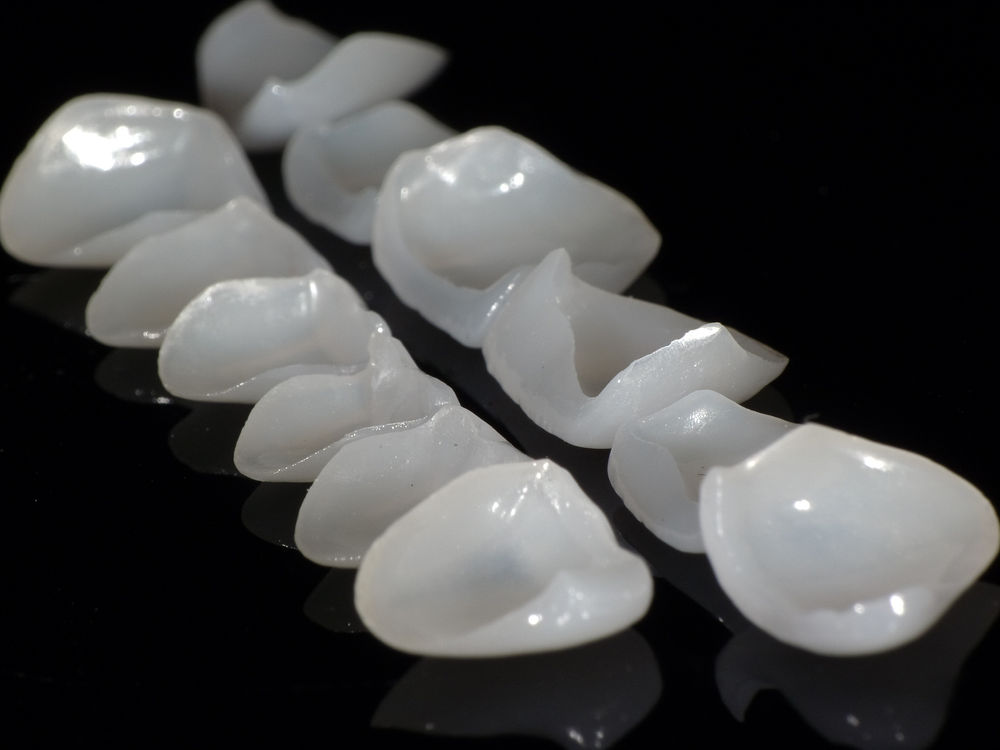 牙齿美容,百奥美全锆贴面还你最美笑容!