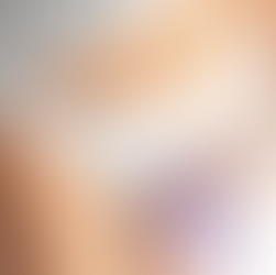 Labioplasty in Turkey: Cost, Recovery & Natural Results