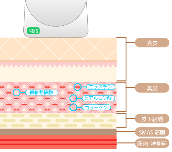 中間市で自分でフェイシャルエステを行うならアップビューティー GIF