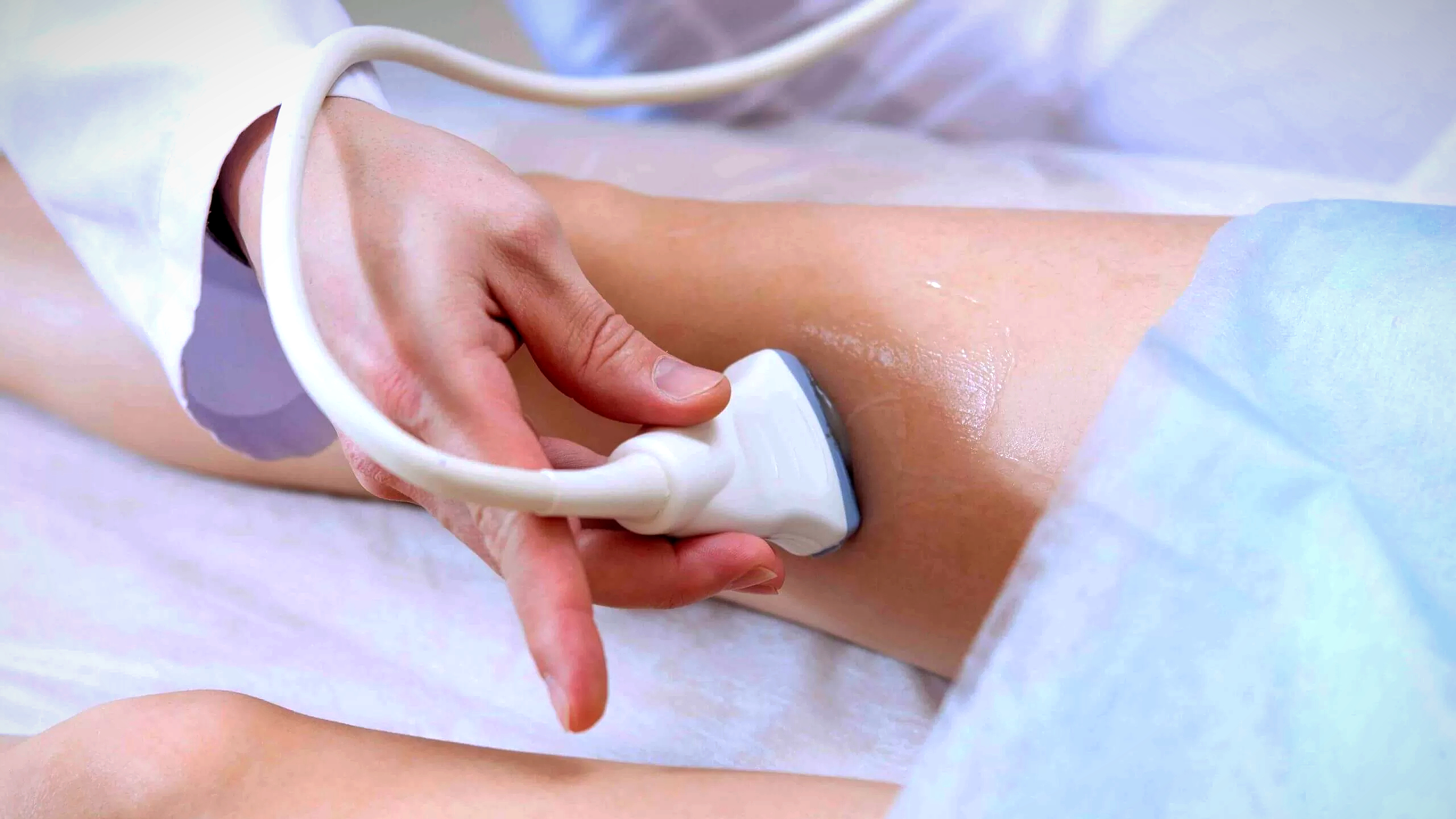 tvp doppler vascular ultrassom veias tep