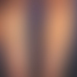 O que Leva uma Pessoa a Ter Varizes?