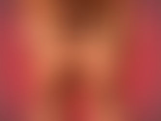 O que é Lipedema? Entenda a Condição e Seus Tratamentos