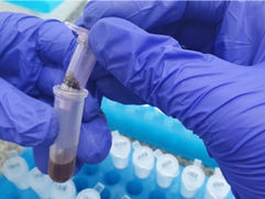 Biodiversidade em Foco: Estudo Inédito Revela Riqueza de Espécies em Área de Restauração