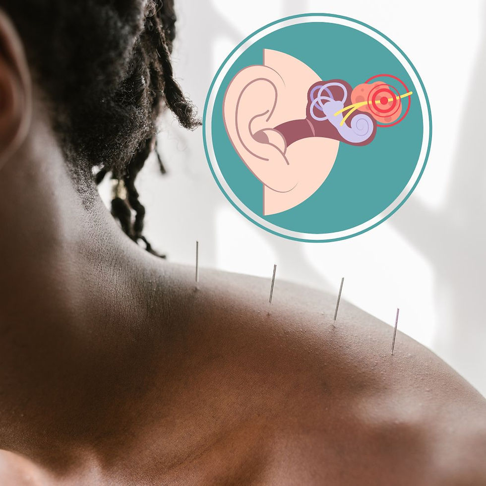 Acupuncture for vertigo
