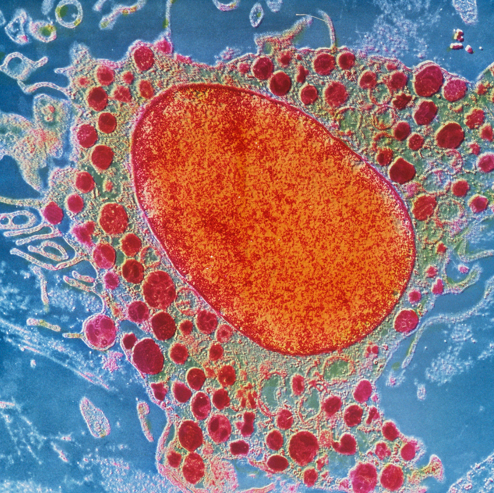 Inflammation