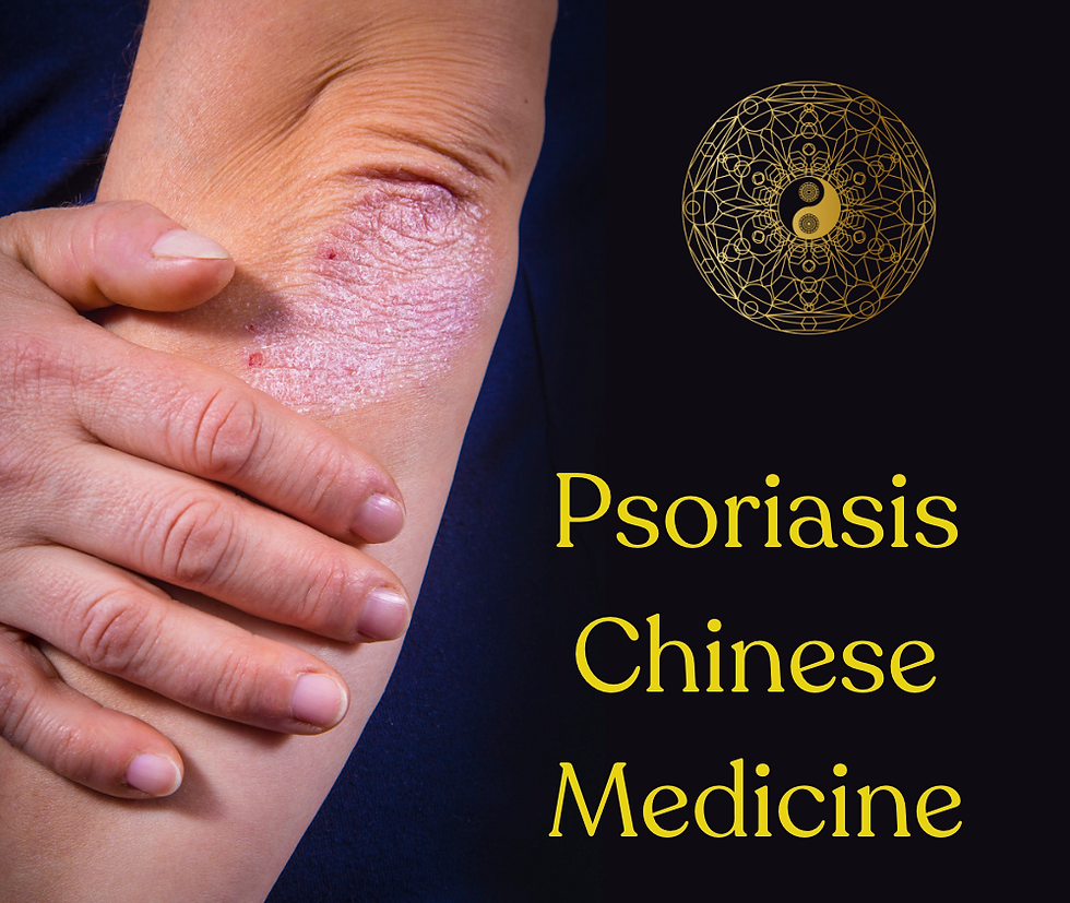 Psoriasis Natural Treatment