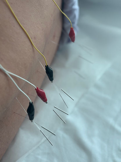 acupuncturen