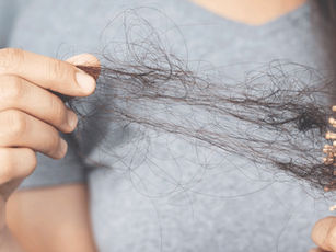 Padání vlasů a psychosomatika: Když tělo mluví za duši