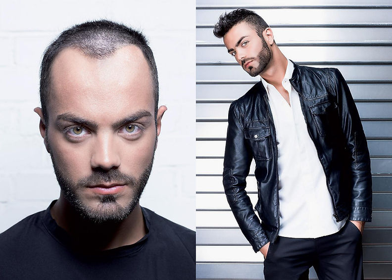 7x5 hair replacement 3.jpg