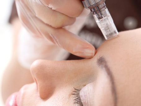 5 PROVEN METHODS TO GROW HAIR ON BALD SPOTS