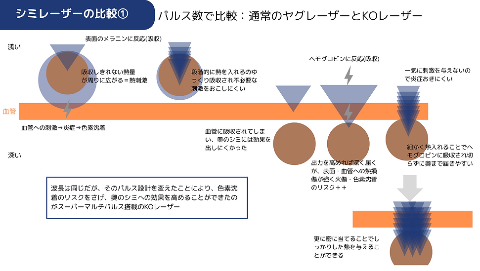 KOレーザー2.png