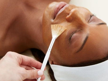 Chemical Peels 