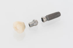 implant
