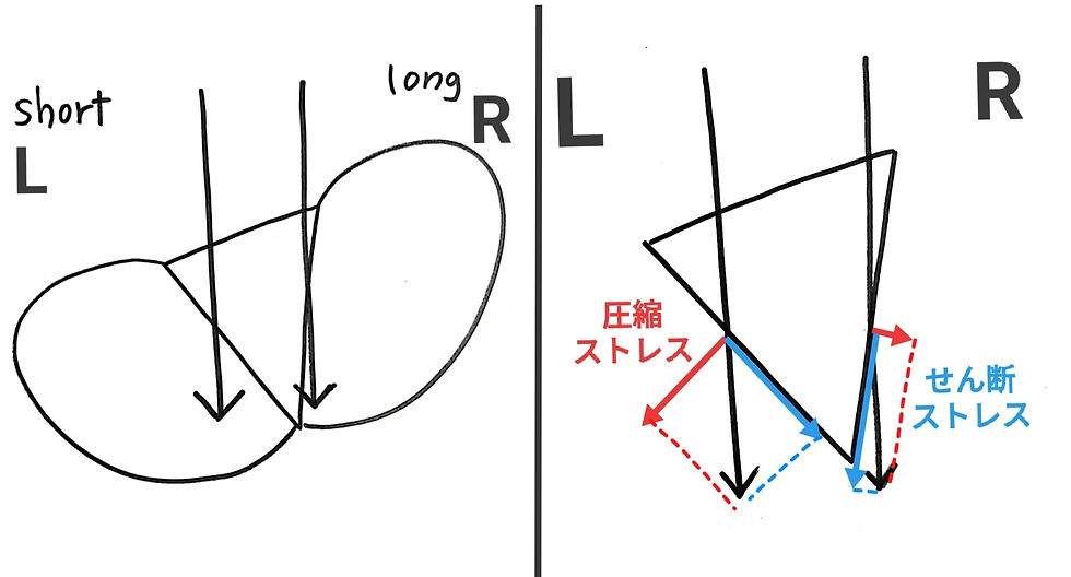 理学療法士のいるジム(東京)パーソナルトレーニングで予防とボディメイク