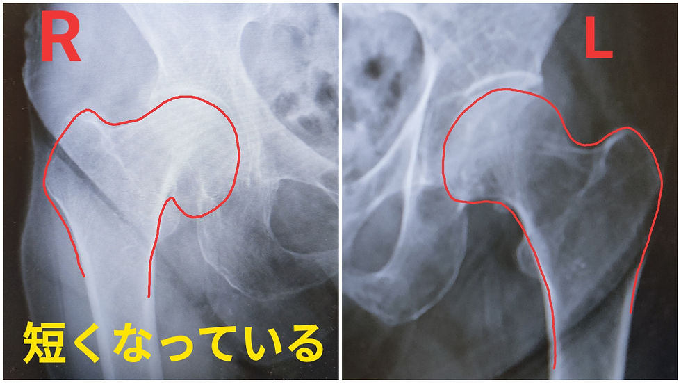 理学療法士のいるジム(東京)パーソナルトレーニングで予防とボディメイク