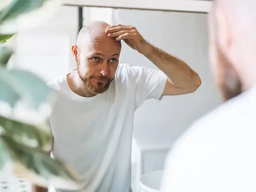 Hair Regrowth for Balding Men: A Comprehensive Guide