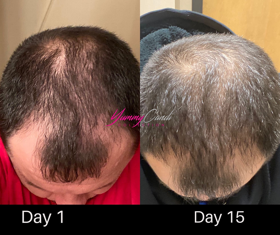 Thumbnail: Hair Growth Scalp Soothing Oil 4oz