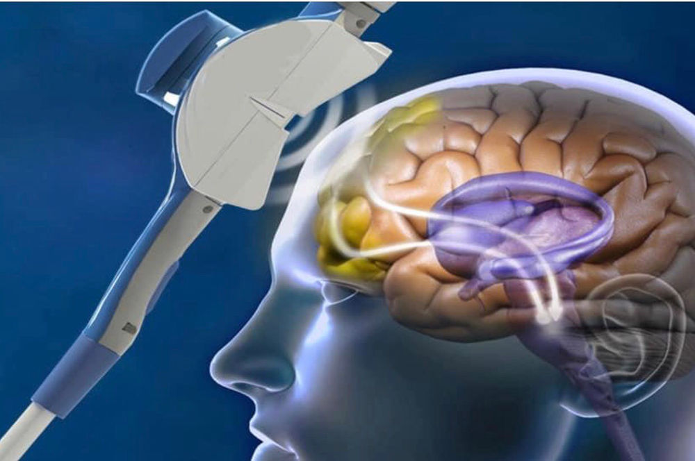 La Distimia la-distimia