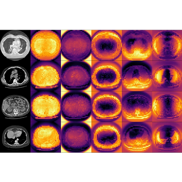 CT foundation model features