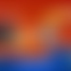 Microlife Viet Nam | Cung cấp thiết bị y tế và chăm sóc sức khỏe