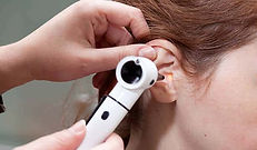 ear-microsuction[1].jpg