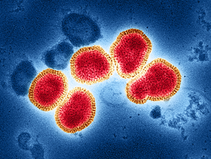 H3N2 Flu: Signs and side effects of the extreme disease to look out for