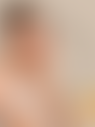 "Sunscreen 101: How to Choose the Best SPF for Your Skin Type"