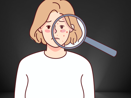 【ニキビに悩んでいる方へ!】肌のケアと改善方法