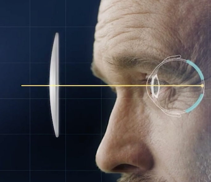 Biometric Lenses Available at Eyecare Plus Mermaid Beach - Rodenstock Lens and Glasses and